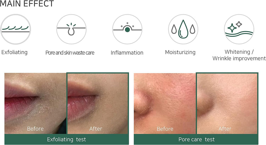 Some By Mi AHA-BHA-PHA 30 Days Miracle Toner 150ml - anti