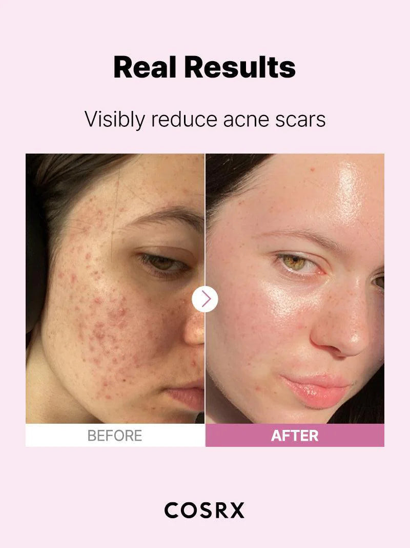 Cosrx  نياسيناميد 15% | متخصص المسام | تفتيح | تنظيم الزيوت