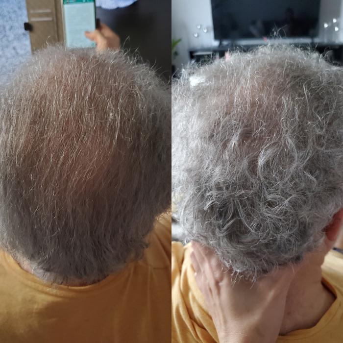 The ordinary سيروم مالتي ببتايد لزيادة كثافة وسمك الشعر 60