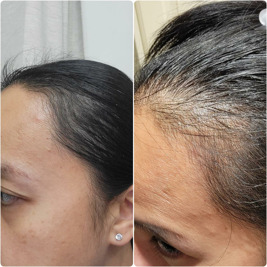The ordinary سيروم مالتي ببتايد لزيادة كثافة وسمك الشعر 60
