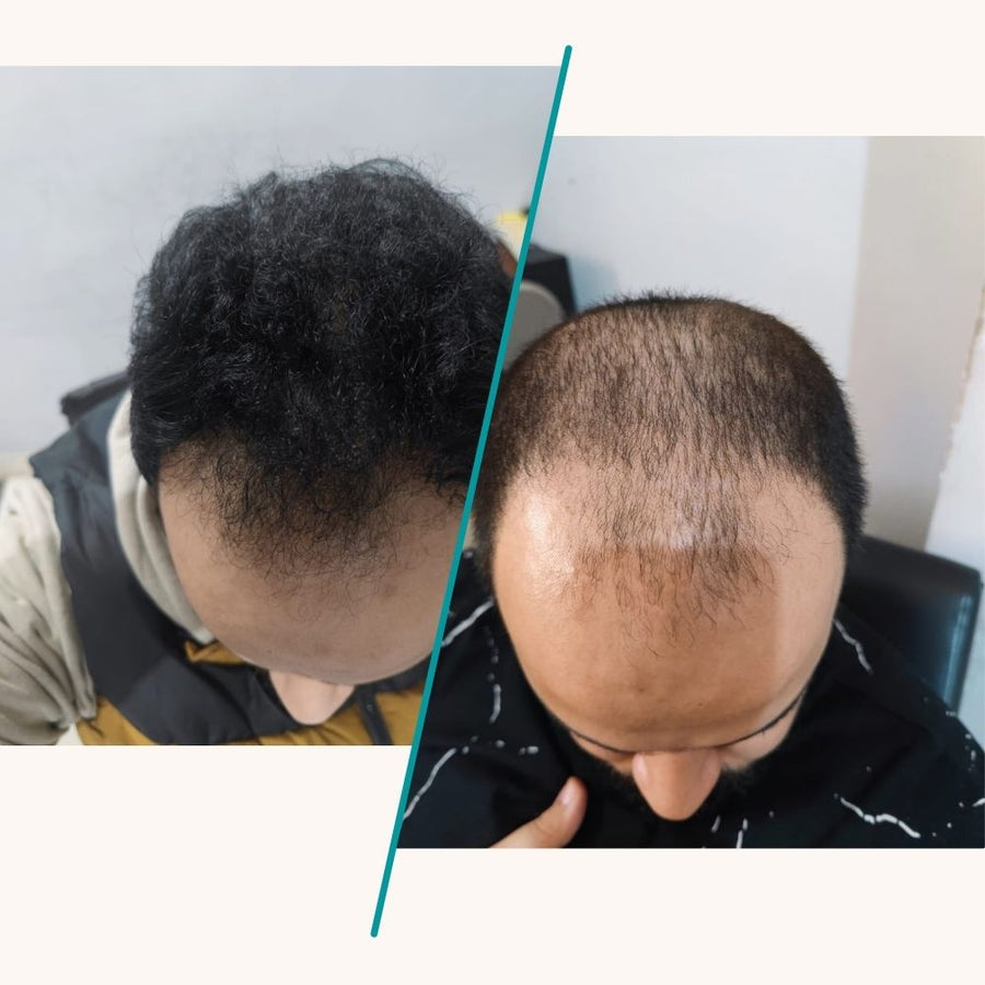 The ordinary سيروم مالتي ببتايد لزيادة كثافة وسمك الشعر 60