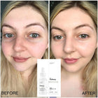 The ordinary نياسيناميد 10% زنك1% - solution